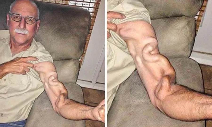 Homem vai se espreguiçar e acaba sentindo uma forte dor no braço, era uma ca… Ver Mais
